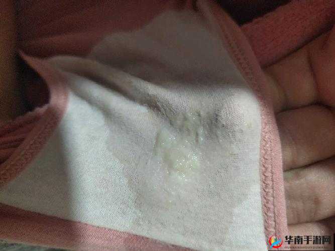 镜流口水流白色液体是否正常相关图片及探讨