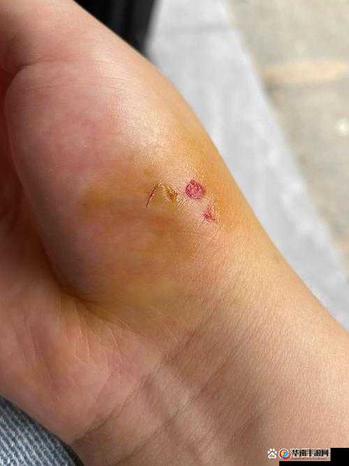 小白兔子被咬的通红：一段令人心疼的意外遭遇