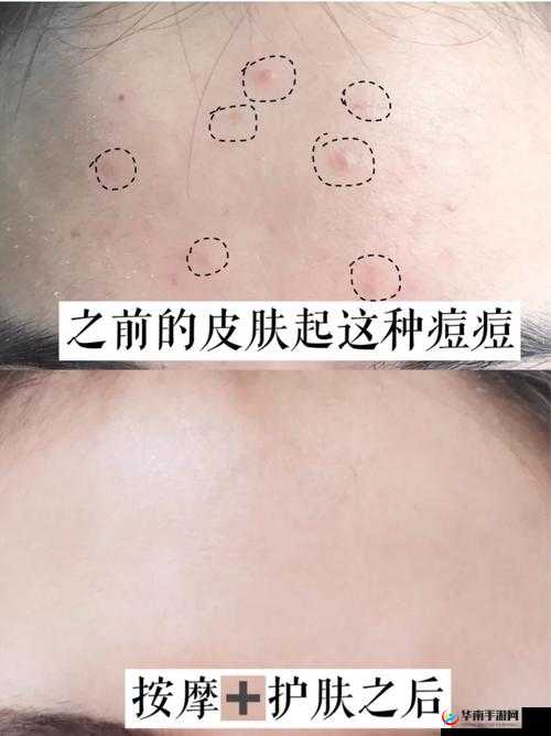 老中医用嘴排阴毒小雨的治疗方法震惊众人引发广泛争议