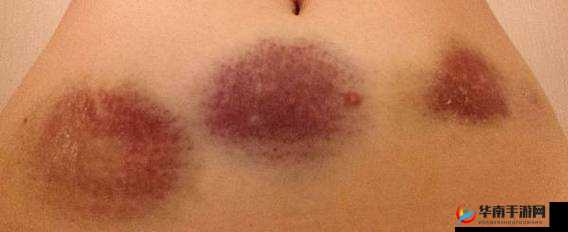 第一次做完后第二天有点出血需留意观察身体状况