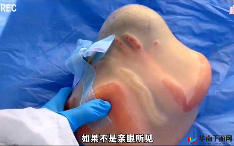 人进羊水门的过程:一段神奇且充满未知的旅程