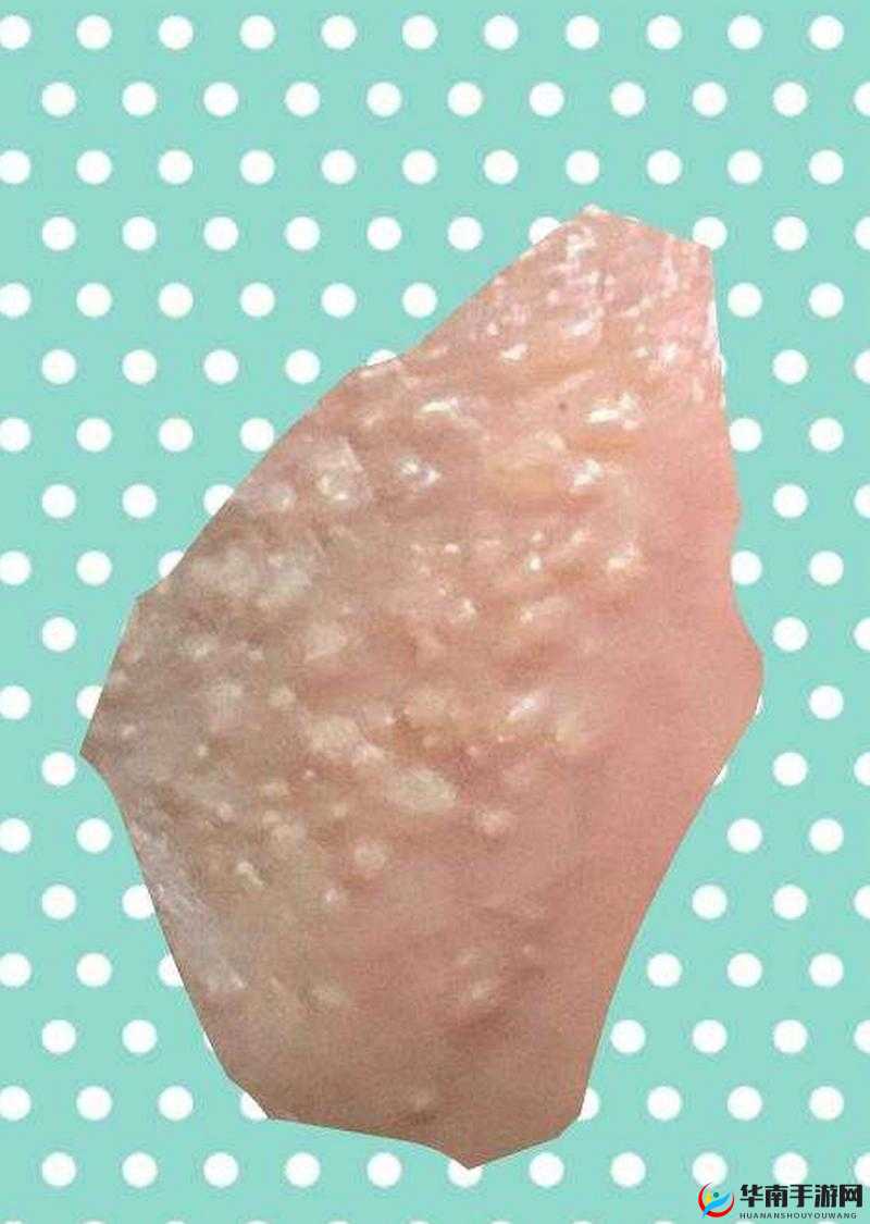 12 岁小学生私密处出现白色黏物需引起重视