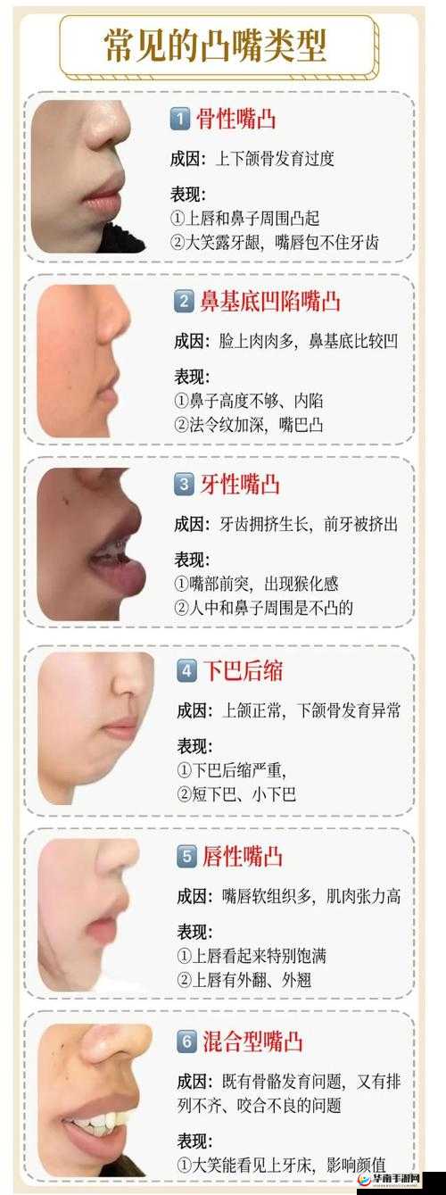 欧美人嘴巴更大还是更小?揭秘不同人种面部特征的差异与科学解释