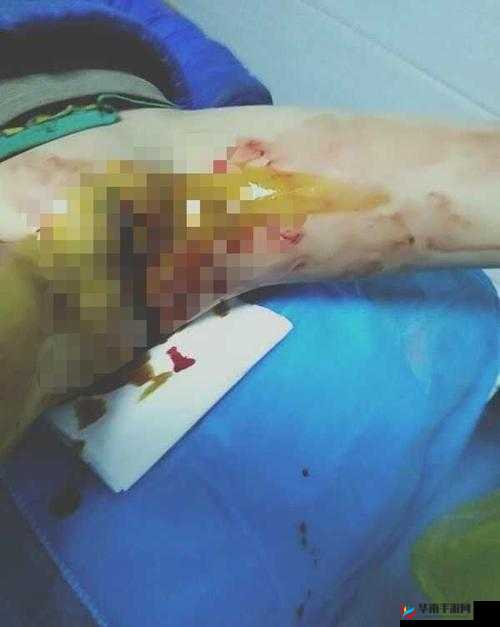 男生女生一起做那种事情，女生下面流血了，是怎么回事？