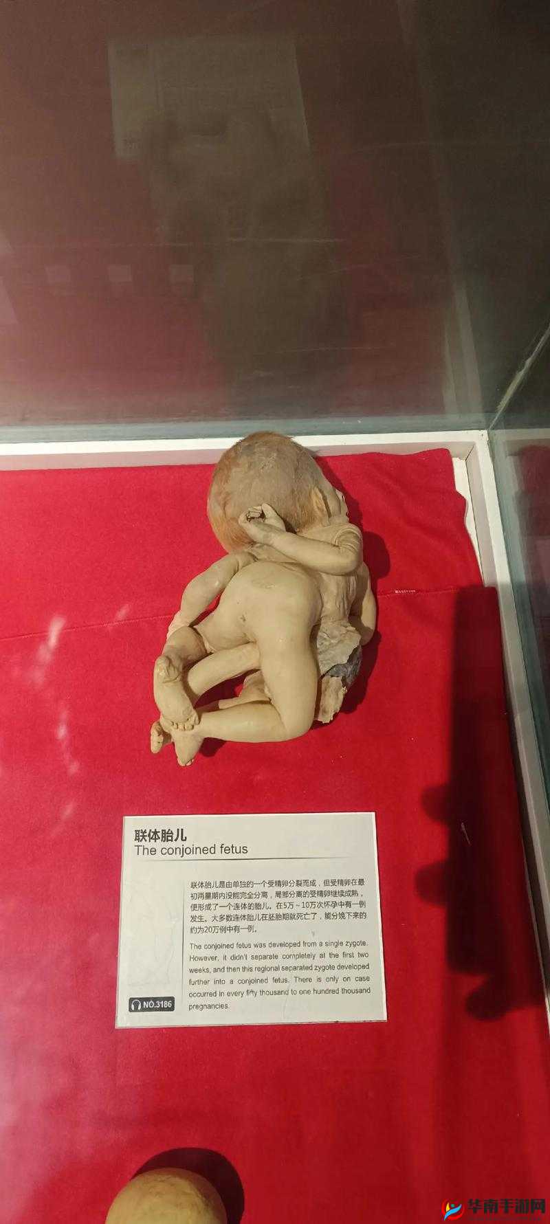 详细解析大体标本的制作过程与保存技巧，助你全面了解大体标本的科学价值与应用