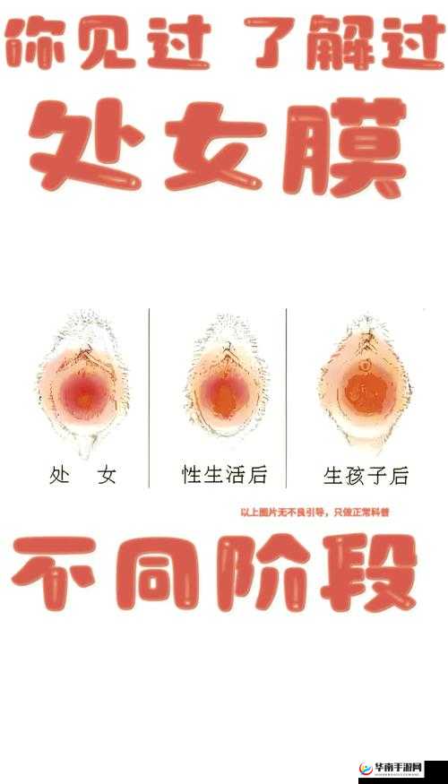 女生如何自己破膜不痛？这个问题困扰着很多人，你知道答案吗？