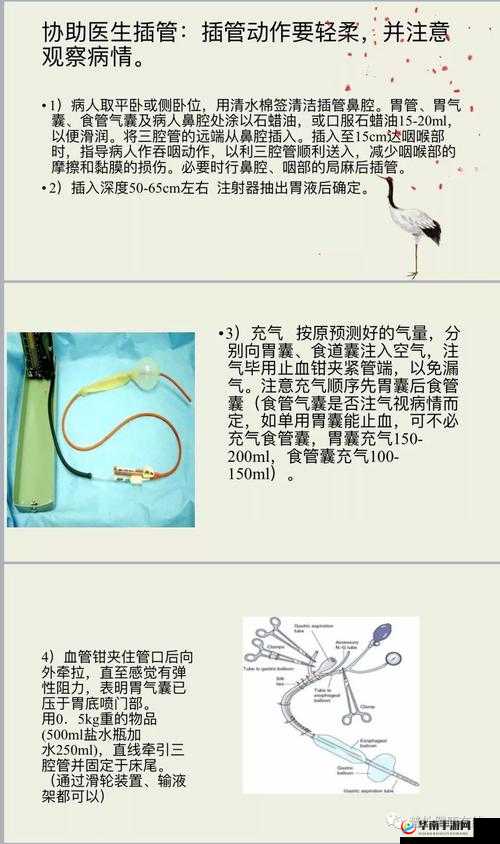 父亲手把手教儿子导管流程：详细步骤与实用技巧分享，助力家庭健康护理