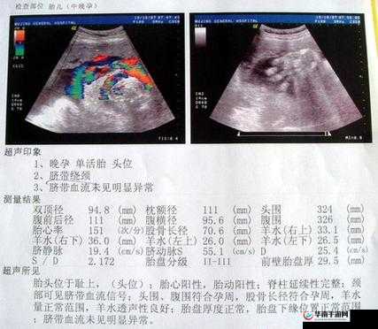 怀孕检查做彩超还是 B 超?哪种更适合?