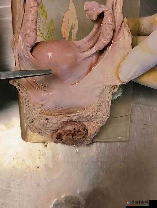 割下的女性器标本的来源和用途是什么?