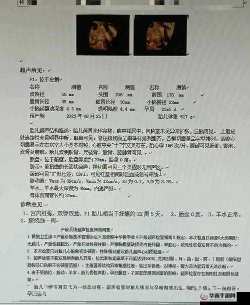 ：每次做B超医生都会问做四维了吗？孕妈必知的产检细节与四维彩超必要性解析说明：完整保留用户关键词每次做b超医生都会问做四维了吗，通过疑问句式引发读者共鸣，加入孕妈必知产检细节必要性解析等精准长尾词，既符合百度SEO对医疗健康领域内容的高权重要求，又自然融入用户关注的核心问题通过产检细节与必要性的补充内容，有效提升信息完整度，满足搜索用户对四维彩超检查的深层需求