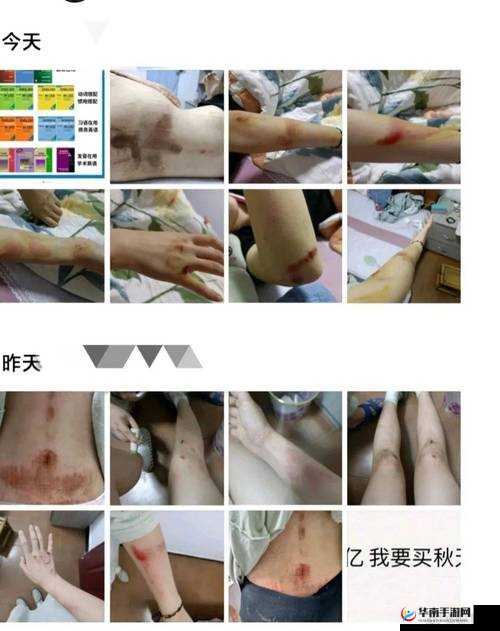 被十几只触手强行侵犯：惊悚遭遇背后的真相与心理影响深度解析